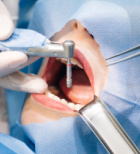 רוצים שתלים להרבה שנים? ביחרו בשיטה המסורתית-תמונה